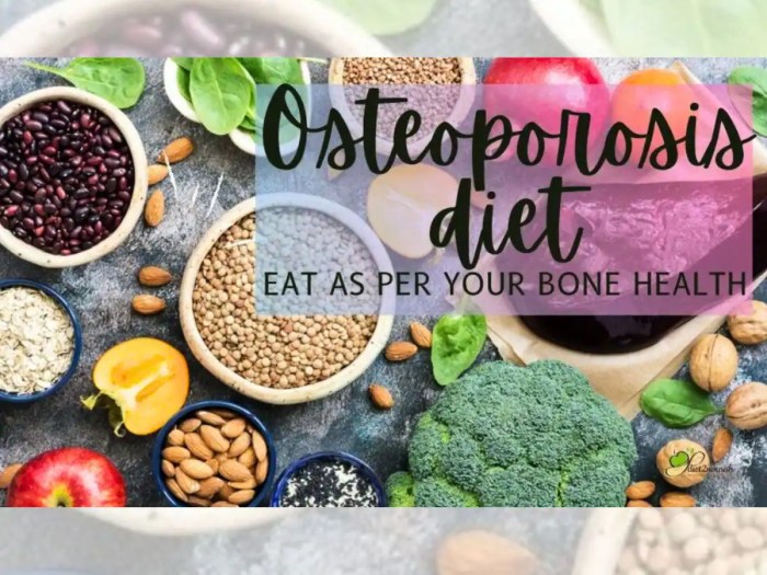 Ernährungs docs osteoporose rezepte